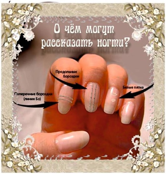 43165591_314251215795402_5065518853065277440_n